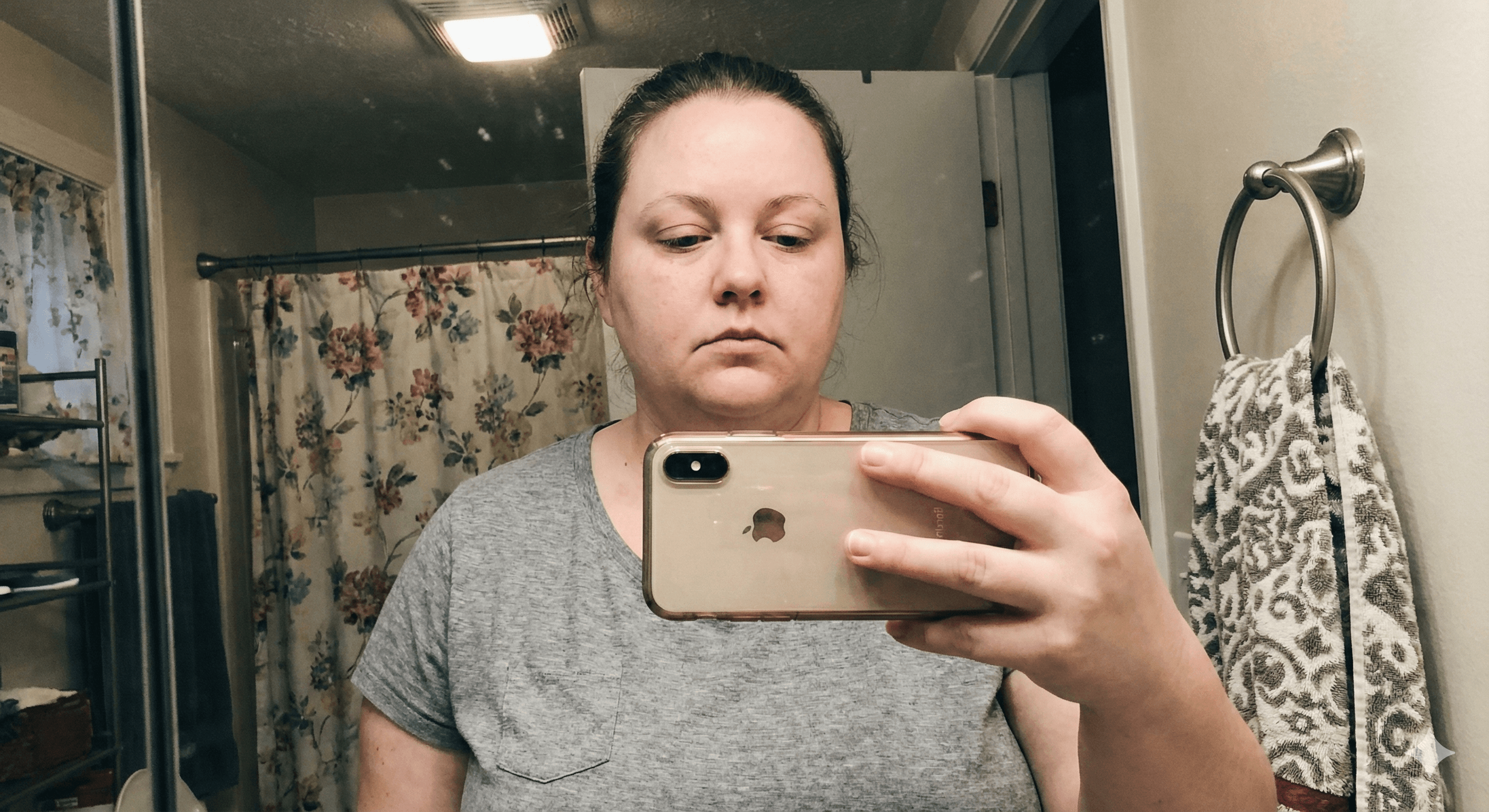 Ozempic vs Wegovy vs Mounjaro vs Zepbound: Which Visualizer Do You Need?